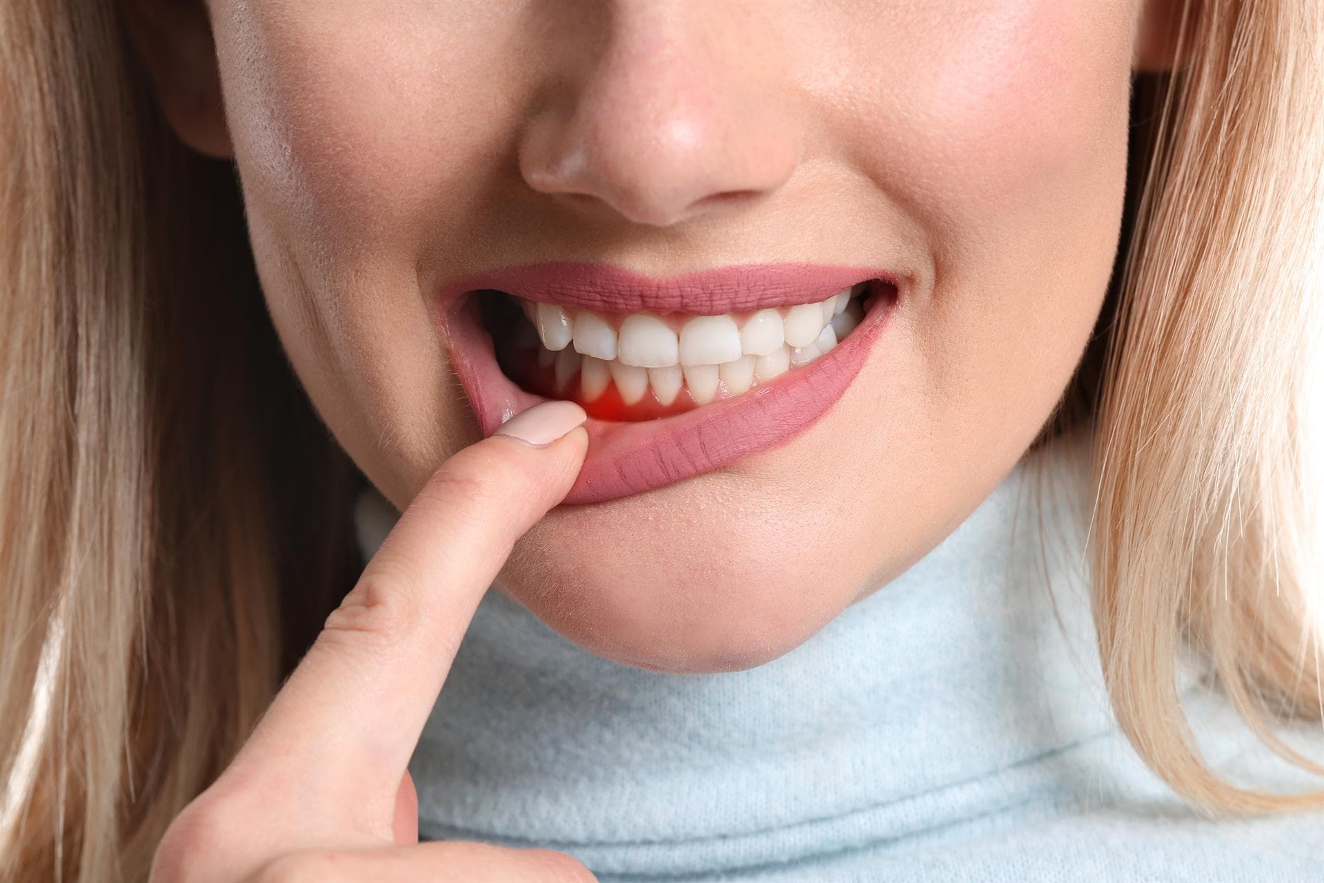    ¿Qué es la periodontitis?