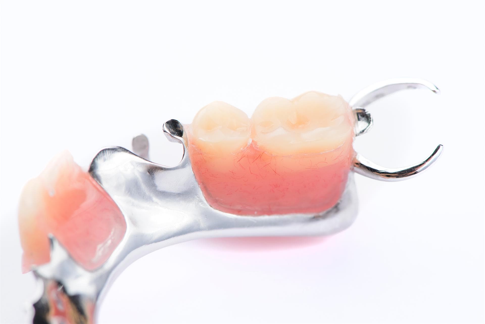  Colocación de prótesis dentales removibles