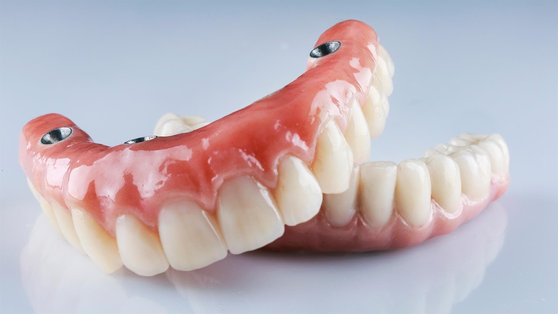 Colocación de prótesis dentales mixtas
