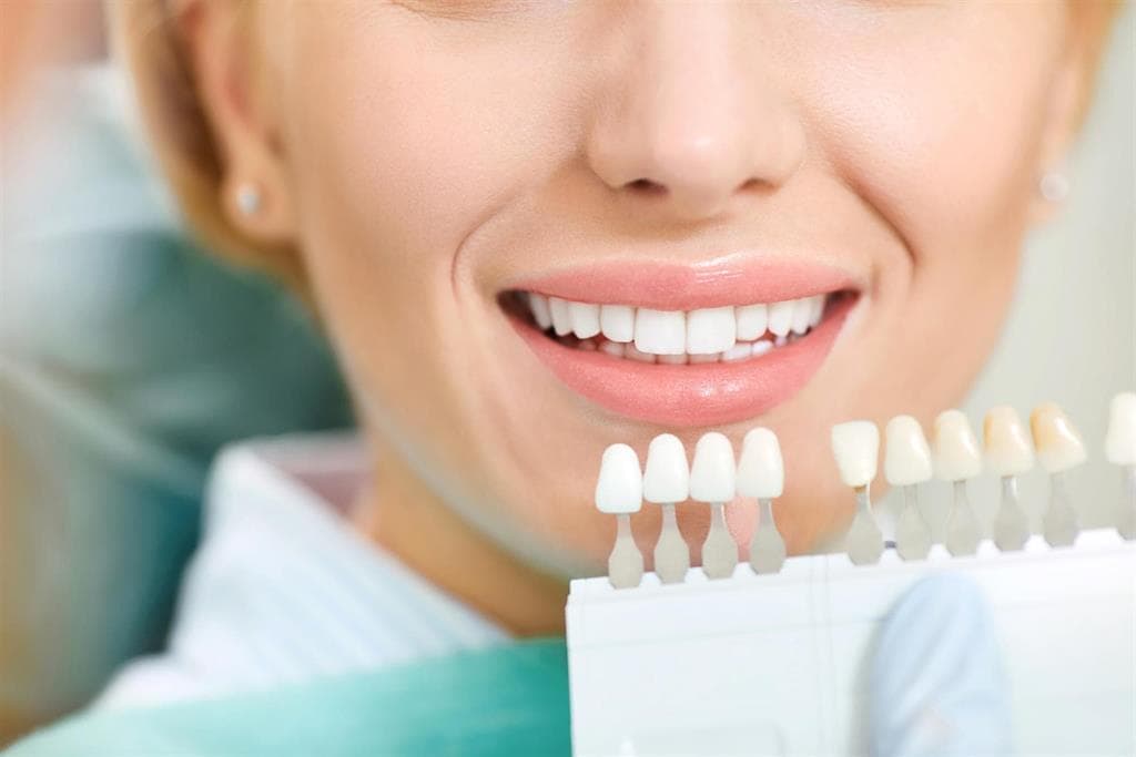 Blanqueamiento dental en Dr. Frutos